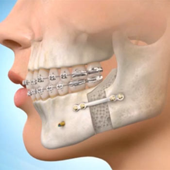 Face, Mouth & Jaw Surgeries in Hyderabad